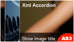 XML Accordion XML Accordion